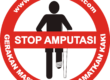 stop amputasi