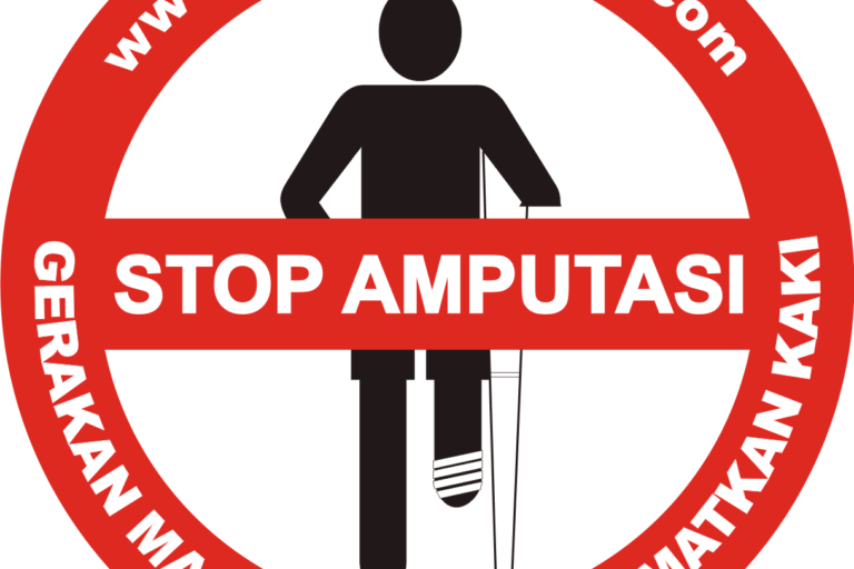 stop amputasi stop amputasi